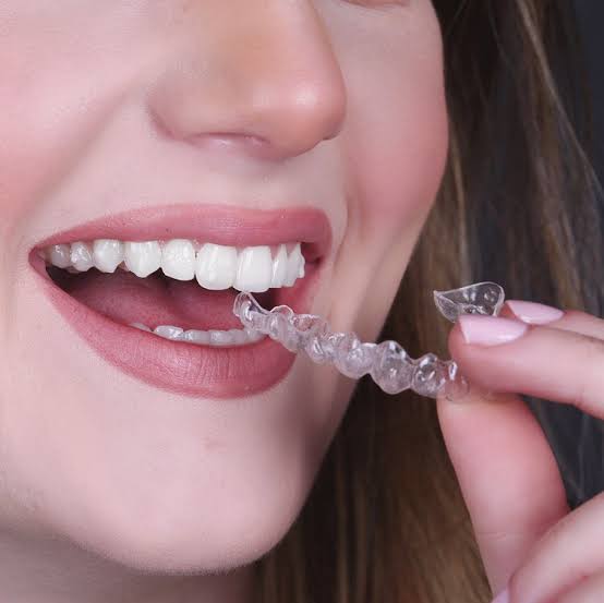 Teeth whitening Offer — 2