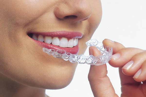 Teeth whitening Offer — 3